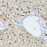 Immunohistochemistry - Anti-ADK Antibody (A92220) - Antibodies.com