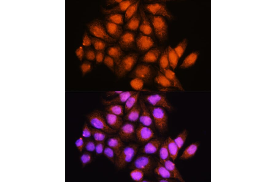 Immunofluorescence - Anti-ADK Antibody (A92220) - Antibodies.com