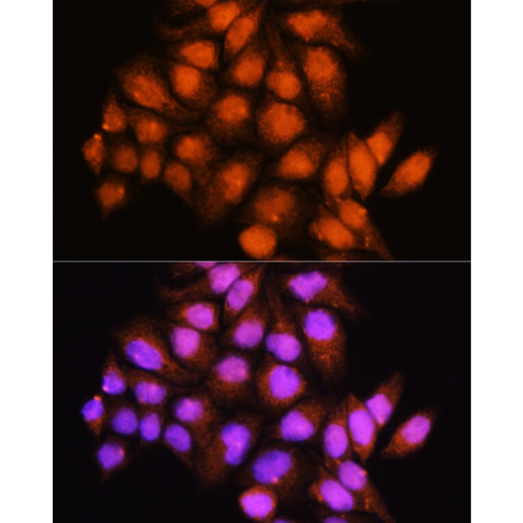 Immunofluorescence - Anti-ADK Antibody (A92220) - Antibodies.com