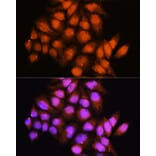 Immunofluorescence - Anti-ADK Antibody (A92220) - Antibodies.com