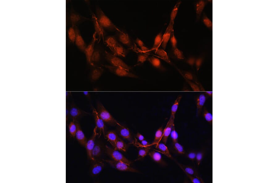 Immunofluorescence - Anti-ADK Antibody (A92220) - Antibodies.com