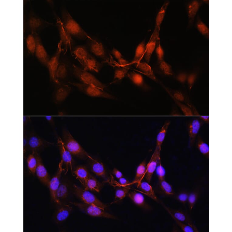 Immunofluorescence - Anti-ADK Antibody (A92220) - Antibodies.com