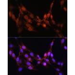 Immunofluorescence - Anti-ADK Antibody (A92220) - Antibodies.com