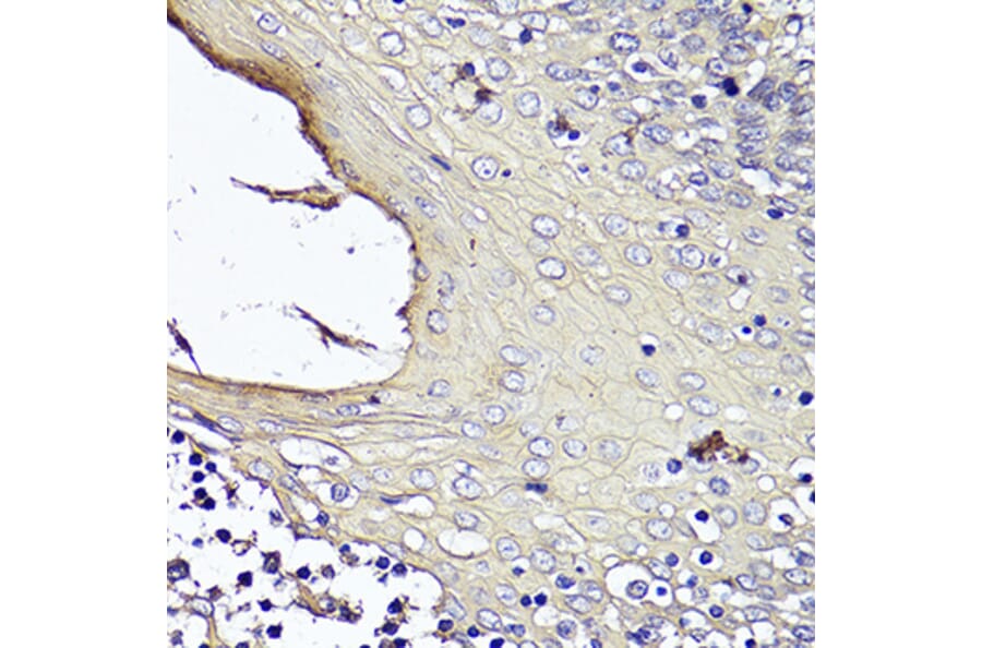Immunohistochemistry - Anti-KRT1 Antibody (A16275) - Antibodies.com