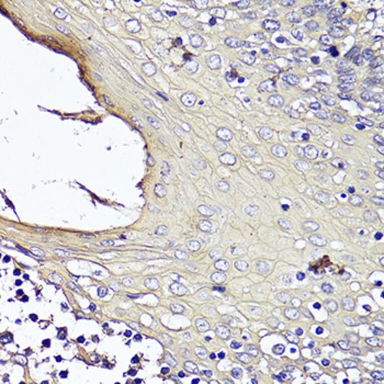 Immunohistochemistry - Anti-KRT1 Antibody (A16275) - Antibodies.com