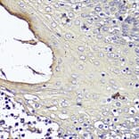 Immunohistochemistry - Anti-KRT1 Antibody (A16275) - Antibodies.com