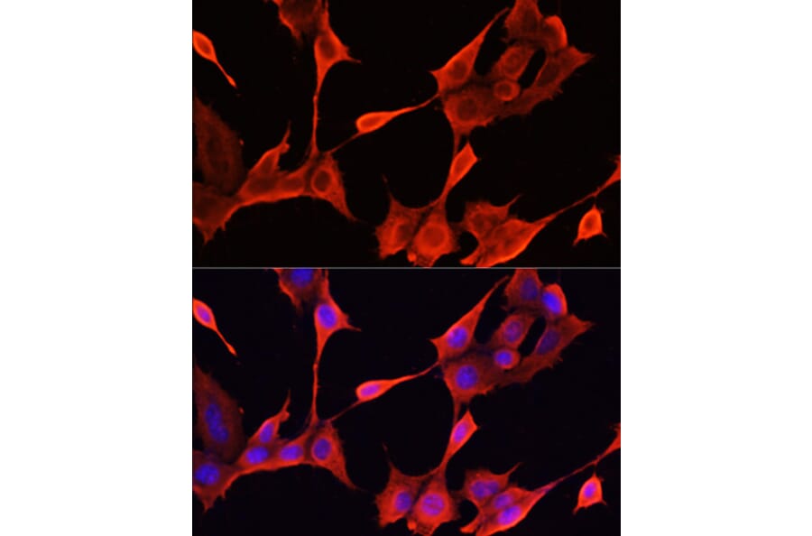 Immunofluorescence - Anti-KRT1 Antibody (A16275) - Antibodies.com