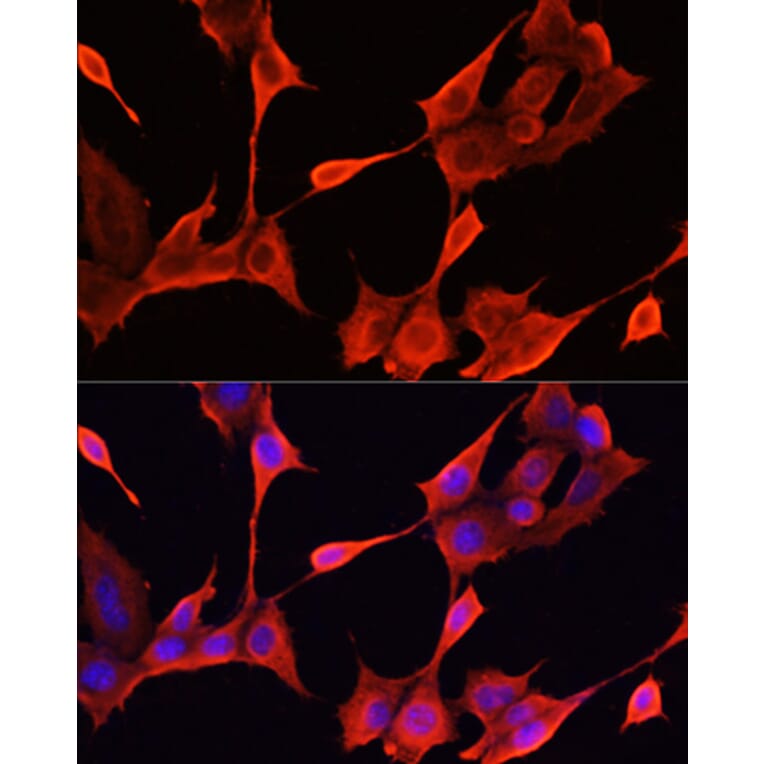 Immunofluorescence - Anti-KRT1 Antibody (A16275) - Antibodies.com