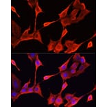 Immunofluorescence - Anti-KRT1 Antibody (A16275) - Antibodies.com