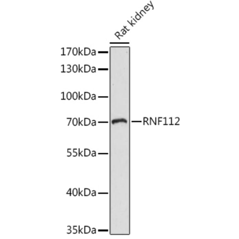 Western Blot - Anti-ZNF179/BFP Antibody (A92224) - Antibodies.com