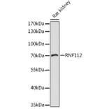 Western Blot - Anti-ZNF179/BFP Antibody (A92224) - Antibodies.com