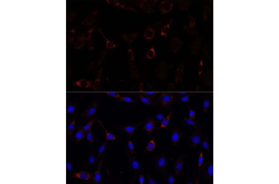 Immunofluorescence - Anti-ZNF179/BFP Antibody (A92224) - Antibodies.com