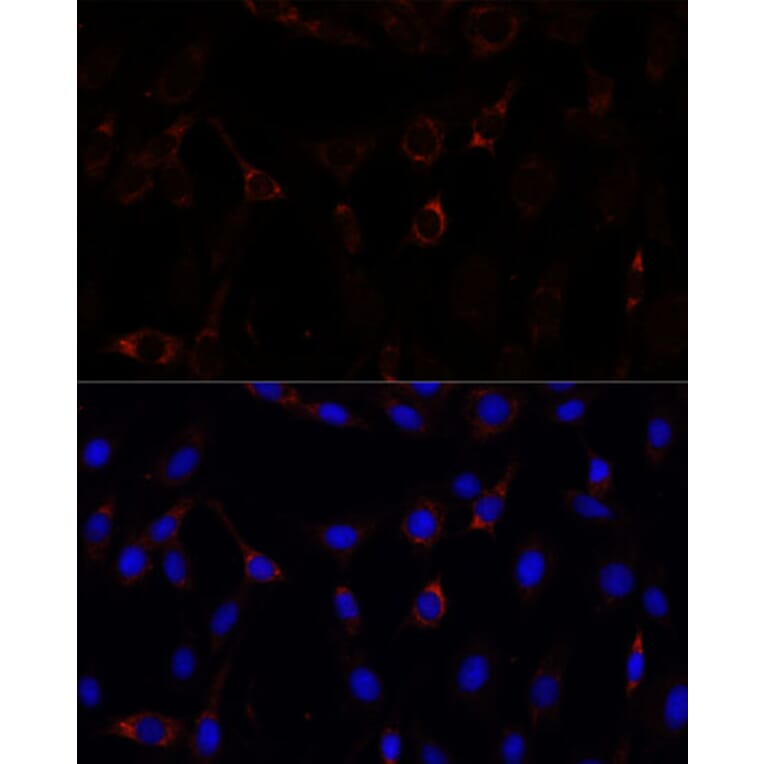 Immunofluorescence - Anti-ZNF179/BFP Antibody (A92224) - Antibodies.com