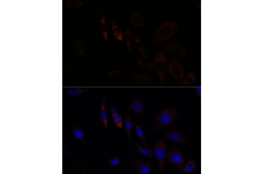 Immunofluorescence - Anti-ZNF179/BFP Antibody (A92224) - Antibodies.com
