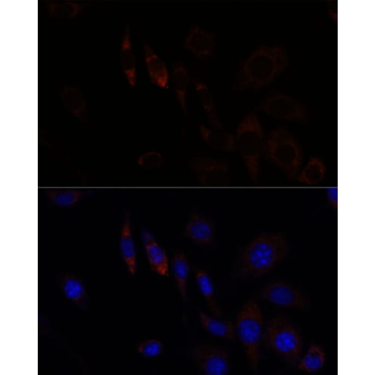 Immunofluorescence - Anti-ZNF179/BFP Antibody (A92224) - Antibodies.com