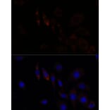 Immunofluorescence - Anti-ZNF179/BFP Antibody (A92224) - Antibodies.com