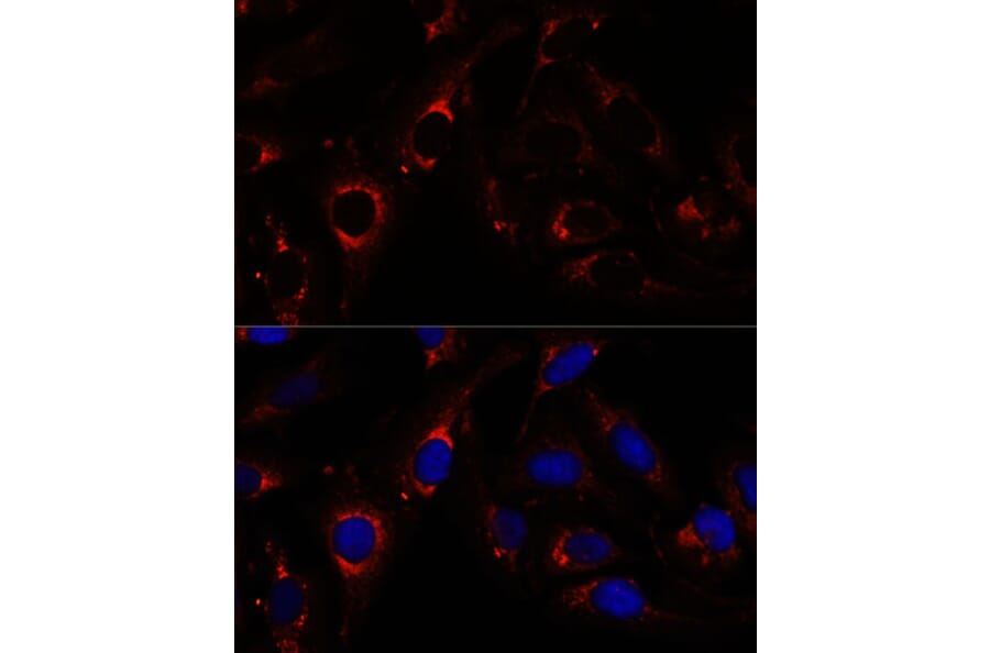 Immunofluorescence - Anti-ZNF179/BFP Antibody (A92224) - Antibodies.com