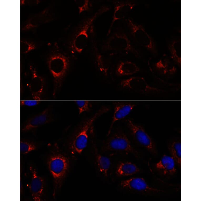 Immunofluorescence - Anti-ZNF179/BFP Antibody (A92224) - Antibodies.com