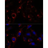 Immunofluorescence - Anti-ZNF179/BFP Antibody (A92224) - Antibodies.com