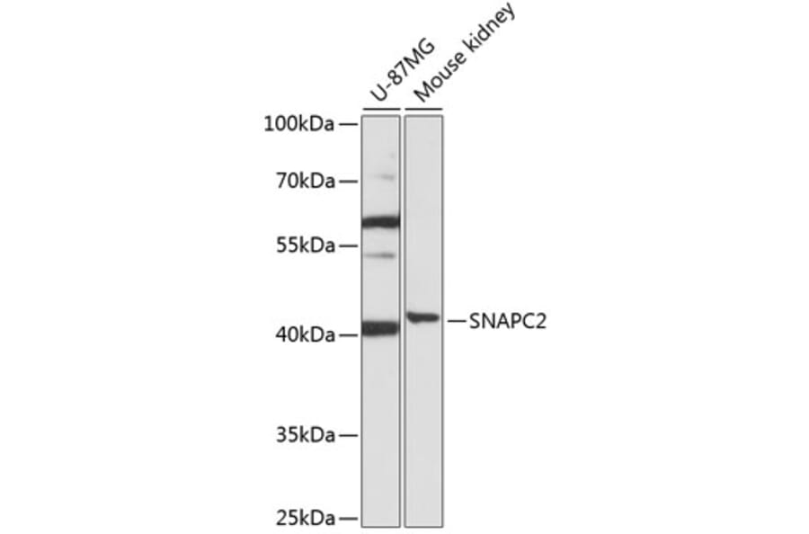 Western Blot - Anti-SNAPC2 Antibody (A92225) - Antibodies.com