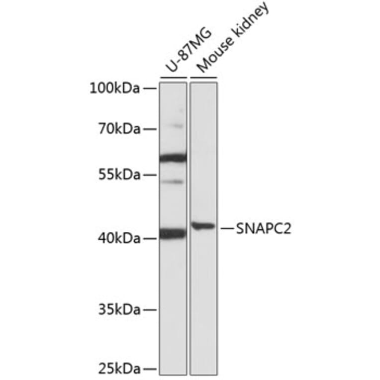 Western Blot - Anti-SNAPC2 Antibody (A92225) - Antibodies.com