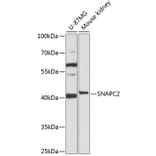 Western Blot - Anti-SNAPC2 Antibody (A92225) - Antibodies.com