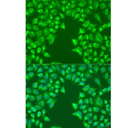 Immunofluorescence - Anti-LRP6 Antibody (A92227) - Antibodies.com