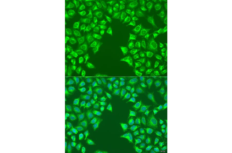 Immunofluorescence - Anti-LRP6 Antibody (A92227) - Antibodies.com
