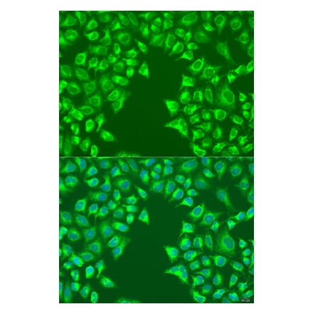 Immunofluorescence - Anti-LRP6 Antibody (A92227) - Antibodies.com