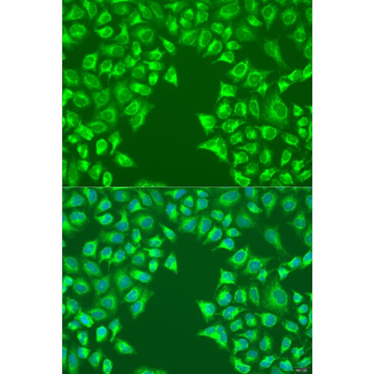 Immunofluorescence - Anti-LRP6 Antibody (A92227) - Antibodies.com