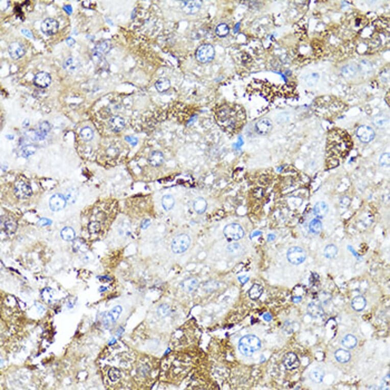 Immunohistochemistry - Anti-COMP Antibody (A16331) - Antibodies.com