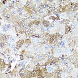 Immunohistochemistry - Anti-COMP Antibody (A16331) - Antibodies.com