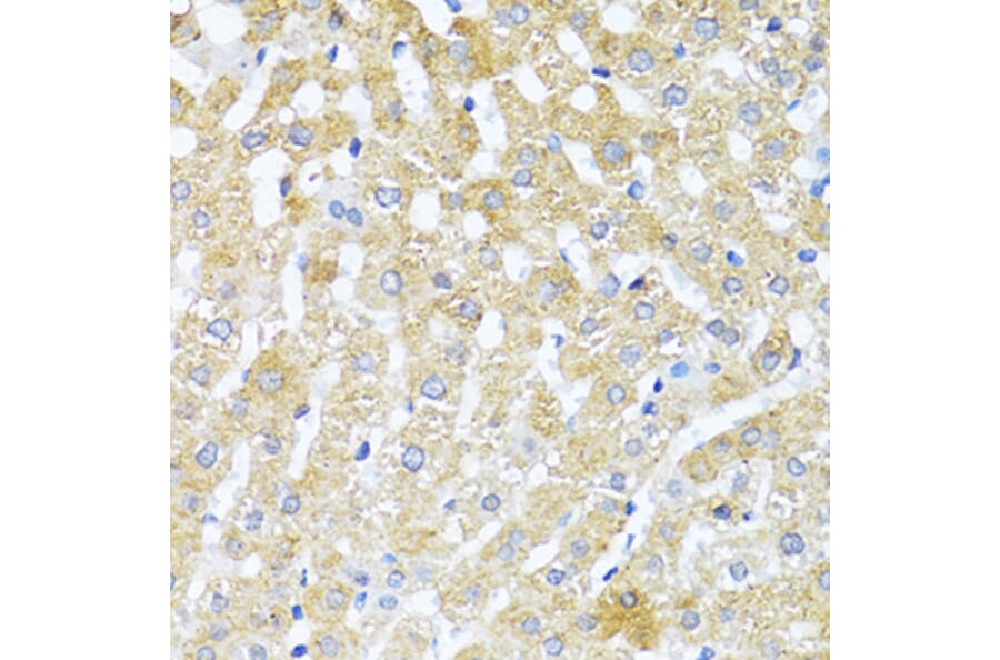 Immunohistochemistry - Anti-TGF beta 2 Antibody (A92229) - Antibodies.com
