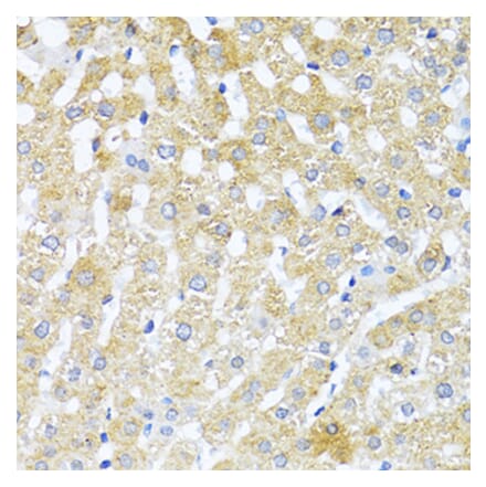 Immunohistochemistry - Anti-TGF beta 2 Antibody (A92229) - Antibodies.com