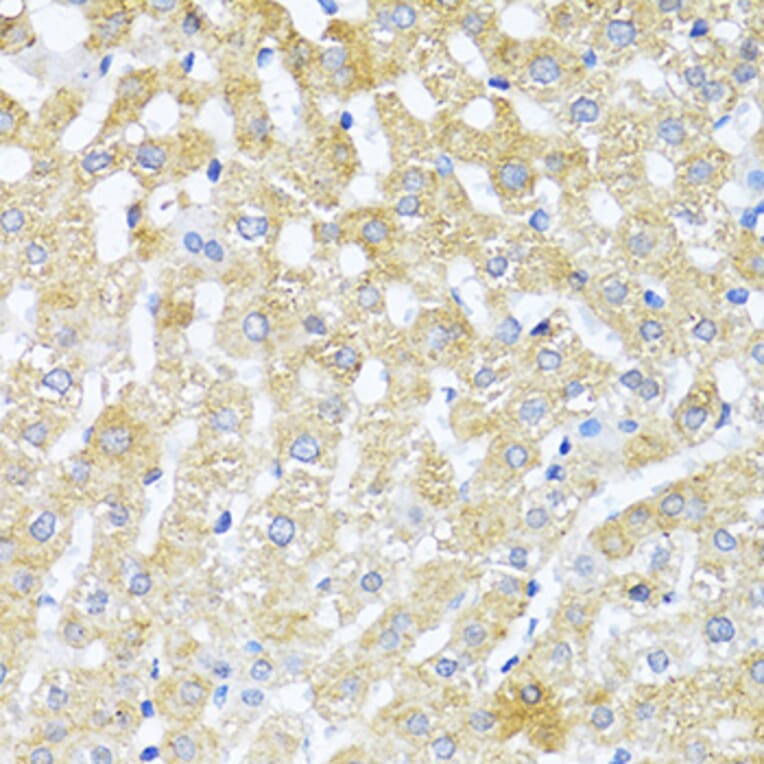 Immunohistochemistry - Anti-TGF beta 2 Antibody (A92229) - Antibodies.com