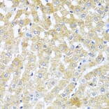 Immunohistochemistry - Anti-TGF beta 2 Antibody (A92229) - Antibodies.com