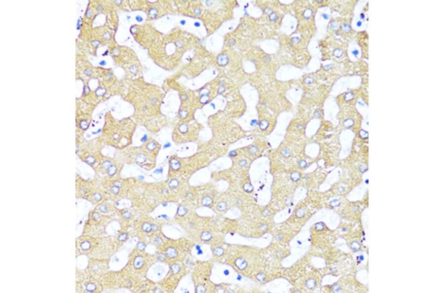 Immunohistochemistry - Anti-TGF beta 2 Antibody (A92229) - Antibodies.com