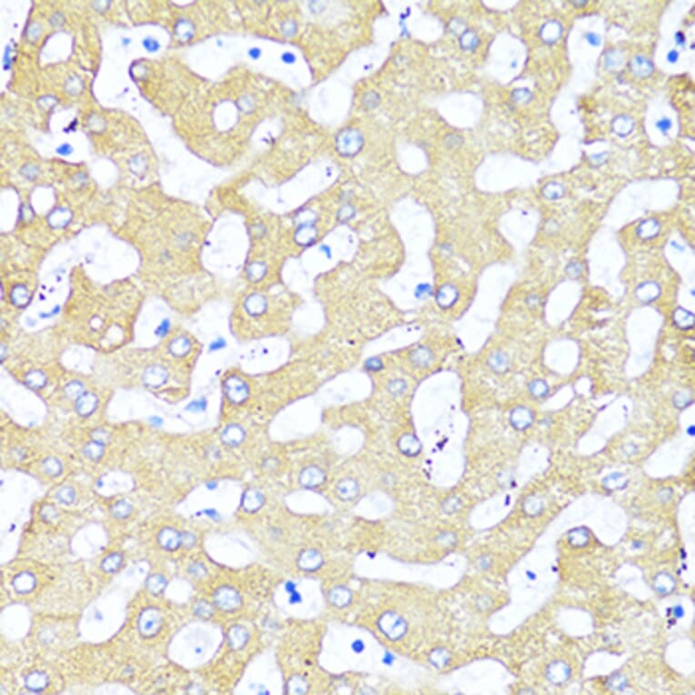 Immunohistochemistry - Anti-TGF beta 2 Antibody (A92229) - Antibodies.com