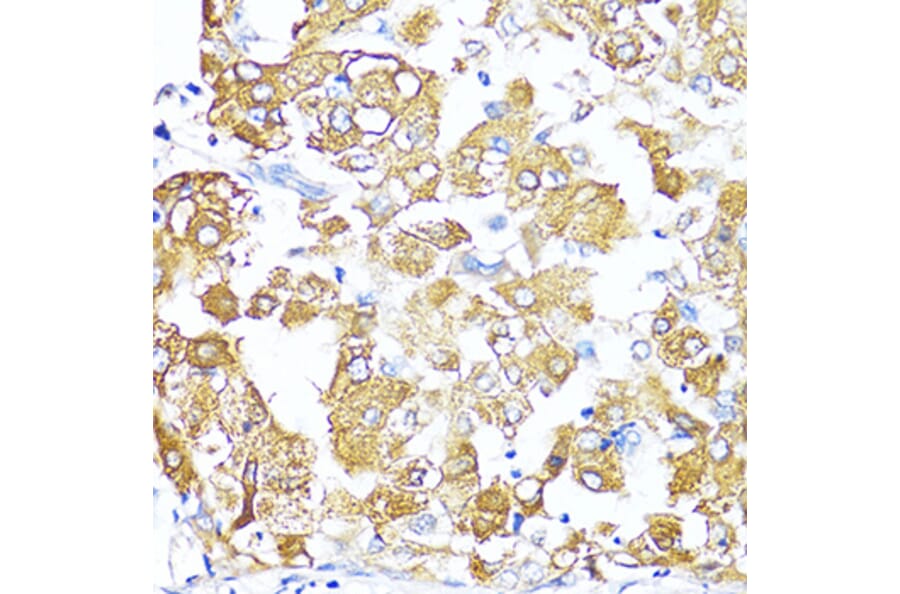 Immunohistochemistry - Anti-TGF beta 2 Antibody (A92229) - Antibodies.com