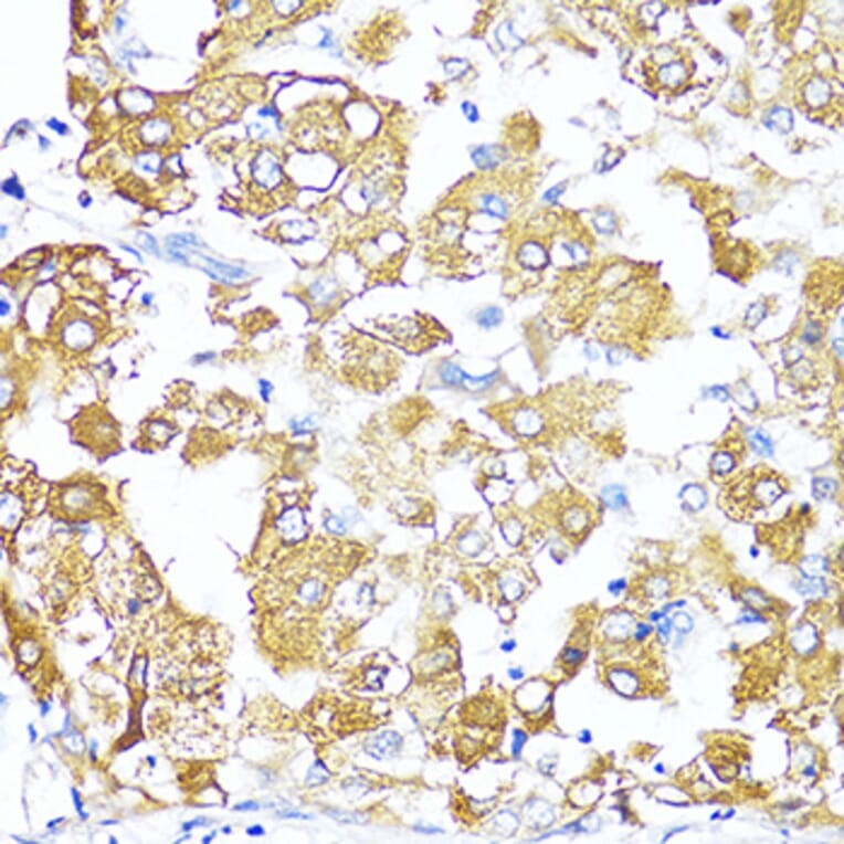 Immunohistochemistry - Anti-TGF beta 2 Antibody (A92229) - Antibodies.com