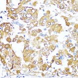Immunohistochemistry - Anti-TGF beta 2 Antibody (A92229) - Antibodies.com