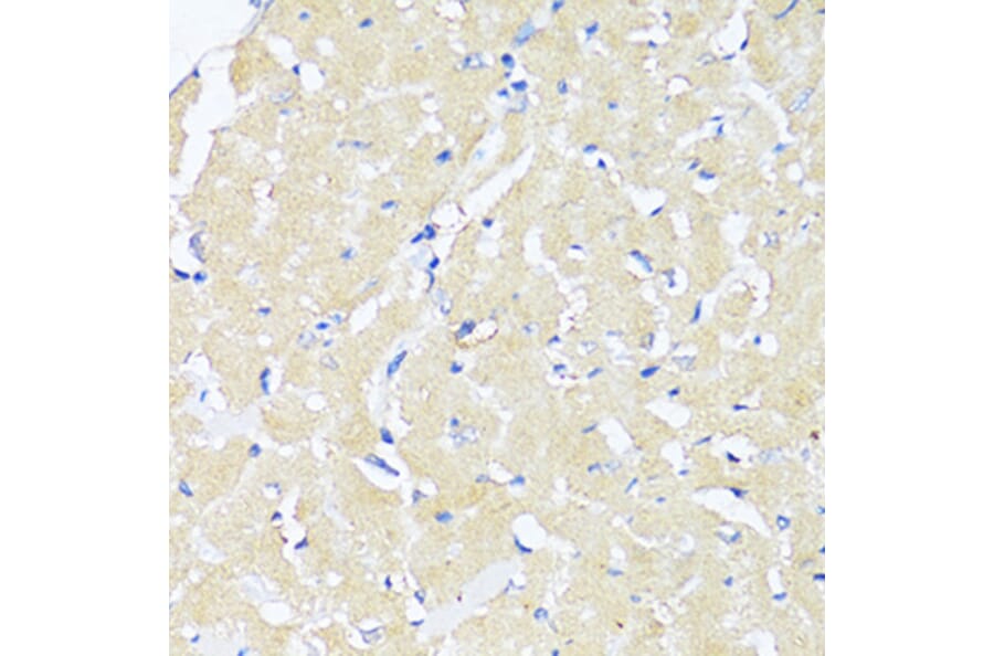 Immunohistochemistry - Anti-TGF beta 2 Antibody (A92229) - Antibodies.com