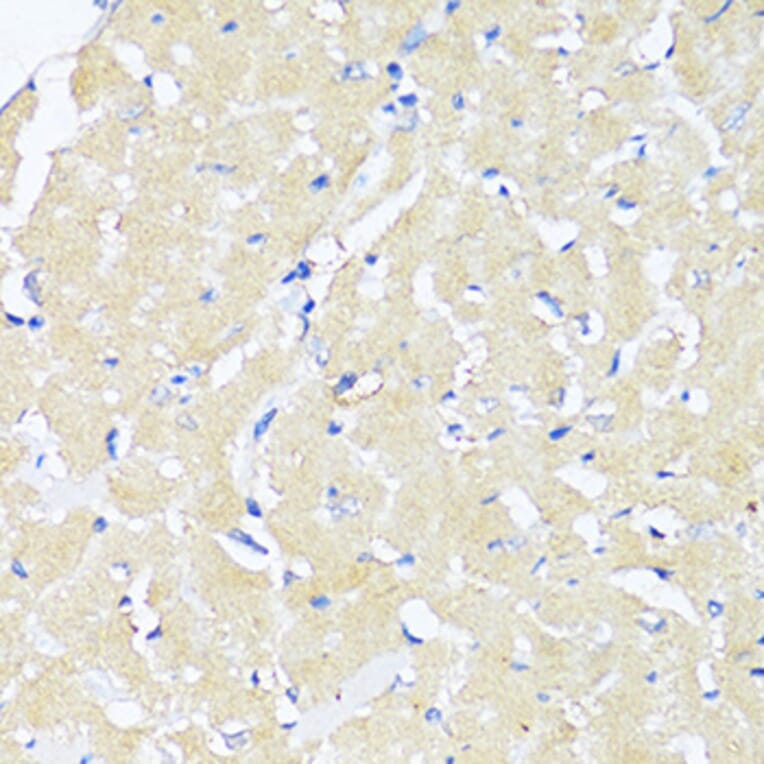 Immunohistochemistry - Anti-TGF beta 2 Antibody (A92229) - Antibodies.com