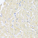 Immunohistochemistry - Anti-TGF beta 2 Antibody (A92229) - Antibodies.com