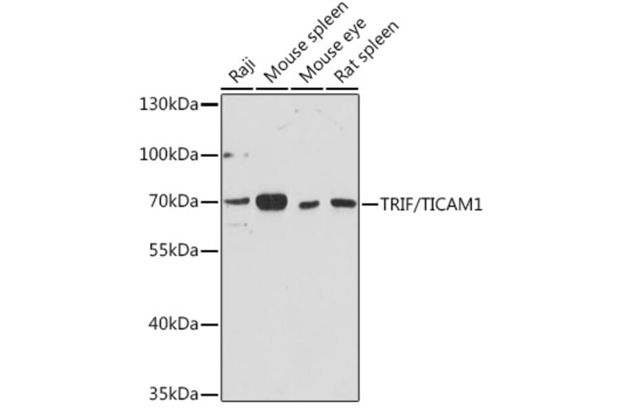 Western Blot - Anti-TRIF Antibody (A92232) - Antibodies.com