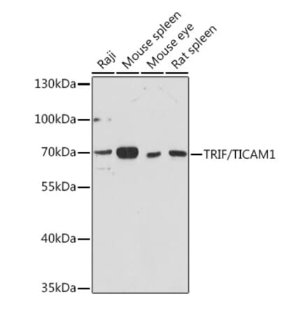 Western Blot - Anti-TRIF Antibody (A92232) - Antibodies.com