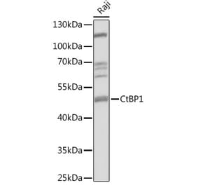 Western Blot - Anti-CtBP1 Antibody (A92234) - Antibodies.com