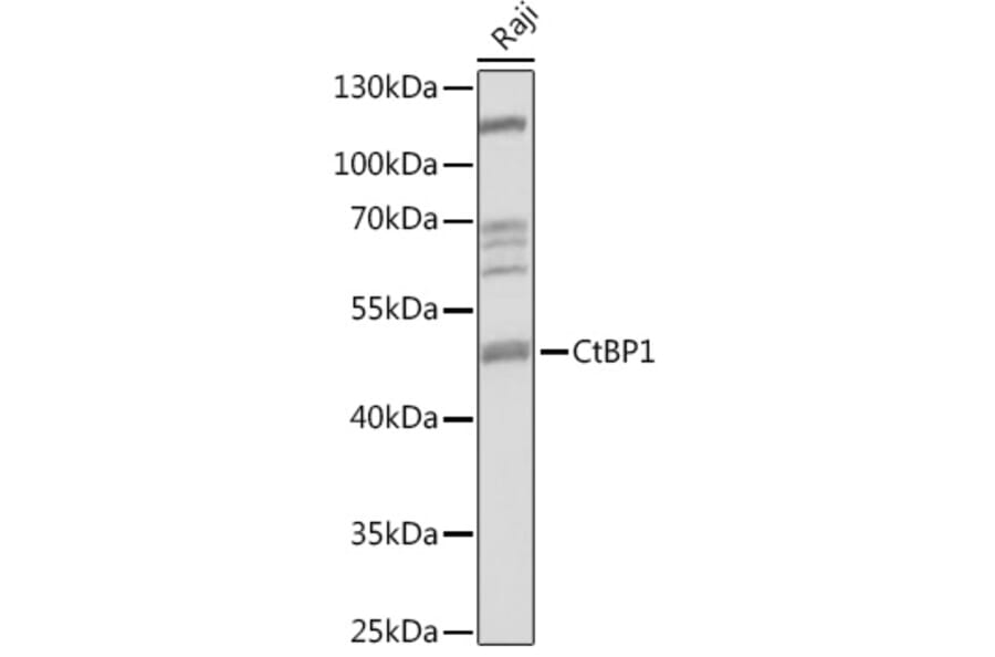 Western Blot - Anti-CtBP1 Antibody (A92234) - Antibodies.com