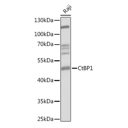 Western Blot - Anti-CtBP1 Antibody (A92234) - Antibodies.com