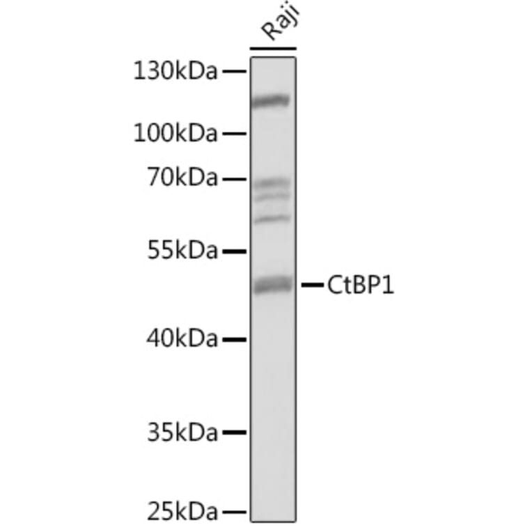 Western Blot - Anti-CtBP1 Antibody (A92234) - Antibodies.com